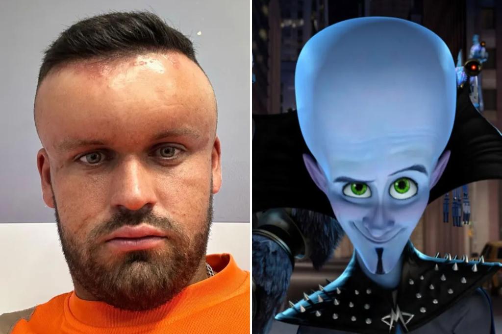 'Massive' hair dye backlash makes man look like 'Megamind' villain