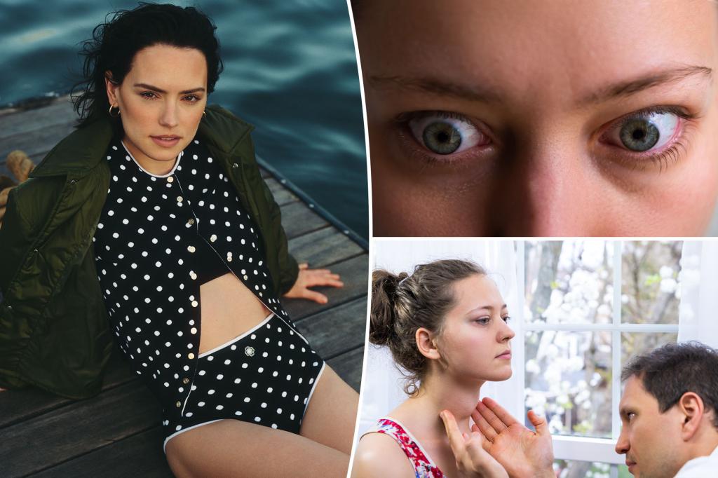 What is Graves' disease?  All about the condition affecting Daisy Ridley