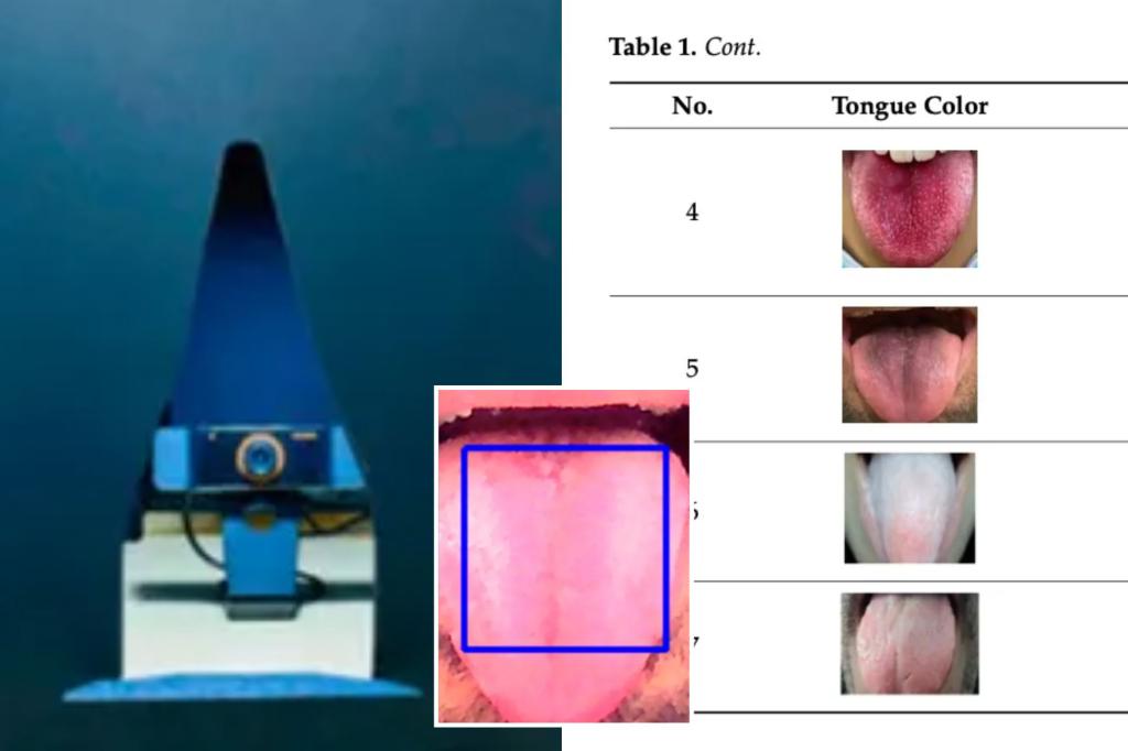 AI model 98% accurate in detecting diseases - just by looking at your tongue