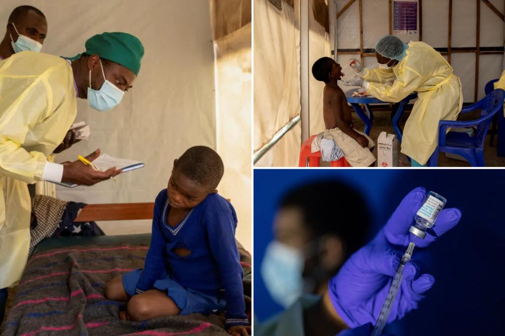 Mpox has been declared a public health emergency in Africa - what is it and what is WHO doing?